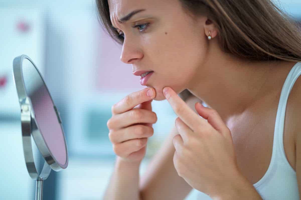 Acne vulgaris bestrijden met vitaminen mineralen