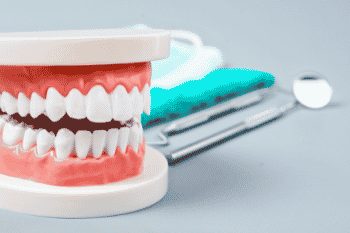 regelmatig de tandarts bezoeken is erg gunstig voor je tanden